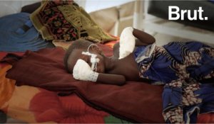 Dans un hôpital d'urgence du Tchad avec les équipes de MSF