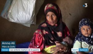 Yémen : les enfants tués par la faim ou les bombes