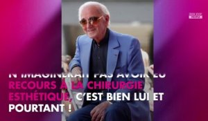 Charles Aznavour mort : pourquoi il s’était fait opérer du nez