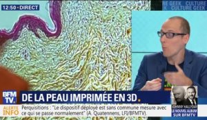 De la peau imprimée en 3D