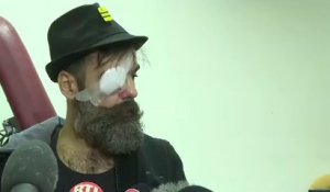 "J'ai subi deux attaques de la part de la police" : blessé à l'œil, le "gilet jaune" Jérôme Rodrigues raconte sa version des faits