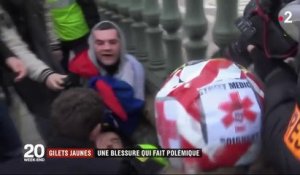 "Gilets jaunes" : la blessure à l'œil de Jérôme Rodrigues fait polémique