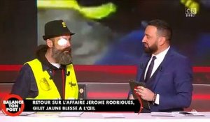 Gilets Jaunes : Jérôme Rodrigues raconte son opération: "Même si je retrouve la vue, si mon oeil me fait mal, on sera obligé de me l'enlever "