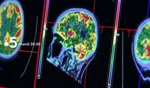 [BA] Enquête de santé - Alzheimer : comment lutter contre la maladie ? - 9/04/2019