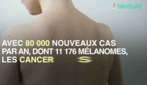 Cancer de la peau : profiter de l'été pour bronzer, une mauvaise idée ?