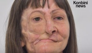 Le visage de cette Brésilienne a été reconstruit grâce à un smartphone et une imprimante 3D