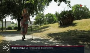 Prothèse bionique : la première Française à recevoir une prothèse bionique de bras doit apprendre à le maîtriser