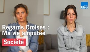 REGARDS CROISÉS - Ma vie amputée : "J'étais persuadée qu'ils allaient recoller ma jambe"