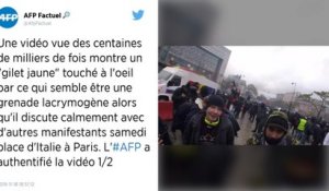 Gilets jaunes. Le manifestant blessé par une grenade lacrymogène a perdu son œil