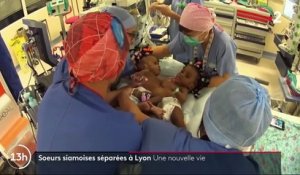 Lyon : une nouvelle vie pour les sœurs siamoises opérées