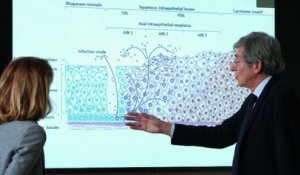 Santé - La vaccination au papillomavirus s'étend aux garçons