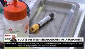 Coronavirus : un test sérologique en laboratoire proposé à Beauvais