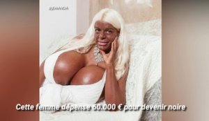 Cette femme dépense 60 000 euros pour devenir noire