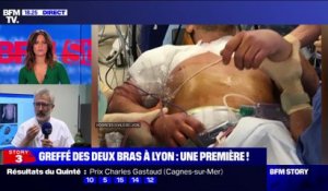 Story 5 : "Tout va bien pour lui", assure le Dr Aram Gazarian responsable de l'opération du premier patient greffé des deux bras et des épaules - 22/01