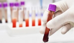 Un nouveau test sanguin pour le cancer serait assez précis pour être lancé