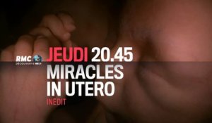 Miracles In Utero - rmc - 3/12