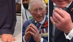Santé du prince Charles: État des mains et des pieds enflés mis à nu – «Doigts de saucisse»