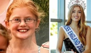 Victime d'intimidation à l'école à cause de ses cheveux roux, elle est devenue Miss Angleterre