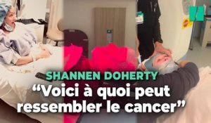 Shannen Doherty dévoile son combat contre une tumeur au cerveau sur les réseaux sociaux