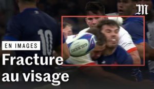 Rugby : la vidéo du choc à la tête reçu par Antoine Dupont