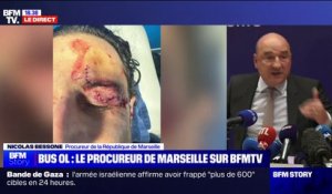 Incidents avant OM/OL: l'ITT de Fabio Grosso réévaluée à "30 jours", rapporte le procureur de Marseille