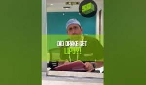 Did Drake Get Lipo?!