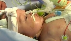 Un bébé de 5 mois sous coeur artificiel dans l'attente d'un don d'organe