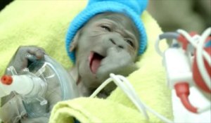 Naissance d'un bébé gorille par césarienne
