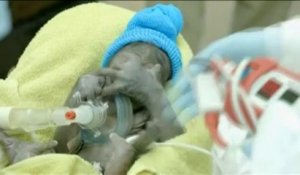 Etats-Unis : un bébé gorille naît par césarienne