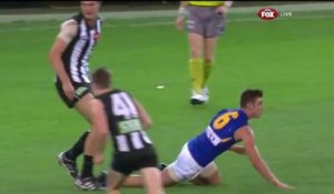 Joueur de Foot Australien perd ses Dents de devant après un choc très violent!