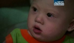 Un bébé trisomique né de mère porteuse abandonné par ses parents