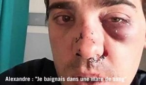 Un client agressé par des taxis : "Je baignais dans une mare de sang"