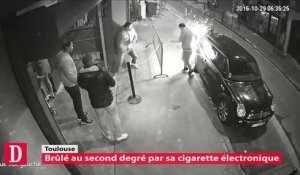 Un Toulousain grièvement brulé après l’explosion de la batterie de sa cigarette éléctronique