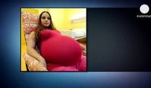 Elle pensait être enceinte de jumeaux, mais les médecins lui montrent quelque chose qui va la faire fondre en larmes