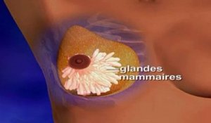 Remodelage mammaire expliqué en vidéo