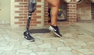 Danse d'une femme unijambiste avec une prothèse de jambe