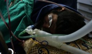 Syrie: dans la Ghouta assiégée, la débrouille des médecins