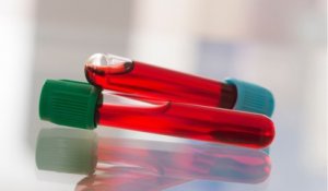 Un test sanguin pour prévenir du cancer avant les premiers symptômes
