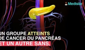 Le cancer du pancréas détecté par un simple alcootest