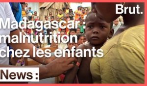 Madagascar : les enfants souffrent de malnutrition
