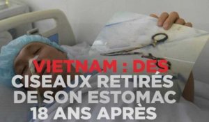 Vietnam : des ciseaux retirés de son estomac 18 ans après