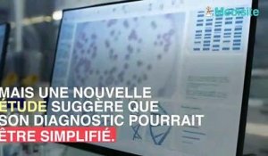 Votre langue pourrait révéler un risque de cancer du pancréas