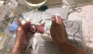 Au Japon, le plus petit bébé du monde est sorti de l'hôpital
