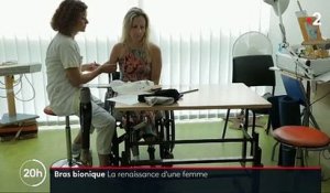 Rencontre avec la première Française à recevoir une prothèse bionique de bras - VIDEO