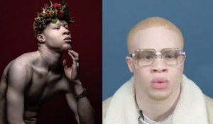 Albinos, j’ai fait de ma différence une force | Le speech d’Hassan Koné