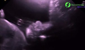 Quand Ton Bebe Te Fait Coucou Depuis L Interieur De Ton Ventre Adorable Sur Orange Videos