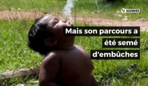 Le garçon de 2 ans qui fumait 40 cigarettes par jour a bien changé