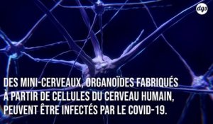 Covid-19 : des « mini-cerveaux »  montrent que le virus peut infecter les cellules du cerveau humain