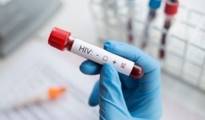 VIH : pour la première fois dans le monde, une femme séropositive guérit grâce à un traitement médical