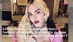 Madonna méconnaissable à 63 ans : ces opérations de chirurgie esthétique qui ont modifié son visage et dont elle refuse de parler